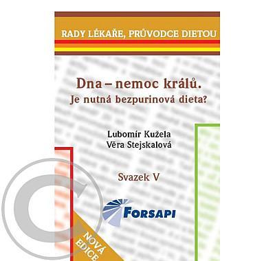 Dna - nemoc králů. Je nutná bezpurinová dieta?